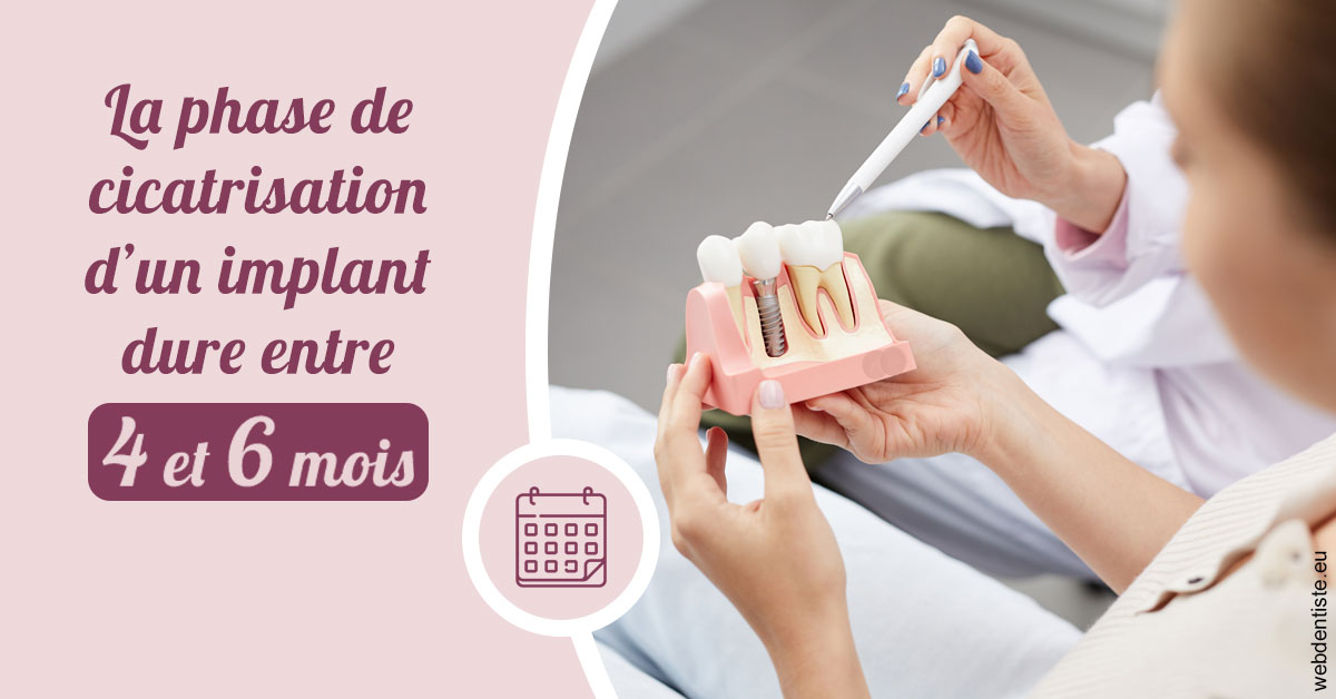 https://dr-voican-ioana.chirurgiens-dentistes.fr/Cicatrisation implant 2