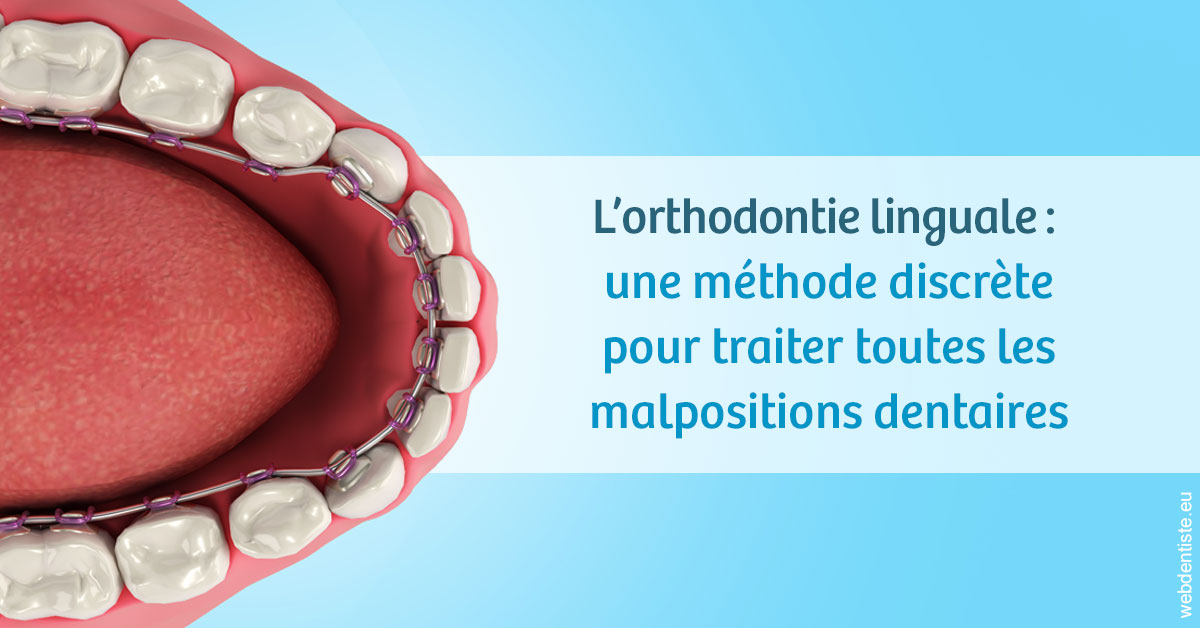 https://dr-voican-ioana.chirurgiens-dentistes.fr/L'orthodontie linguale 1