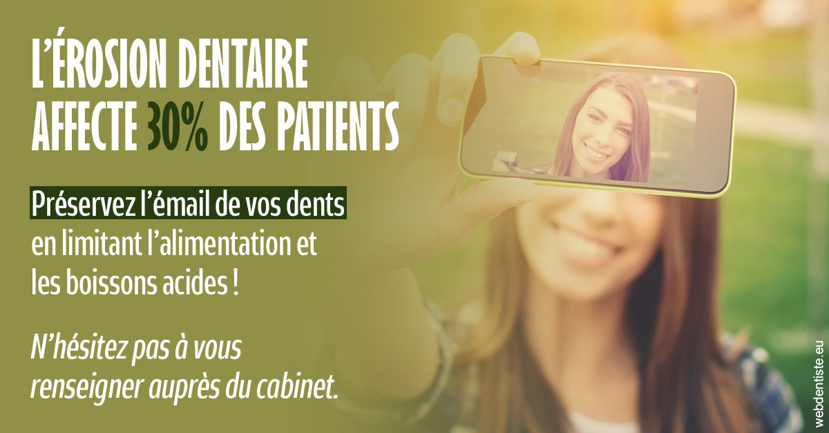 https://dr-voican-ioana.chirurgiens-dentistes.fr/L'érosion dentaire 1