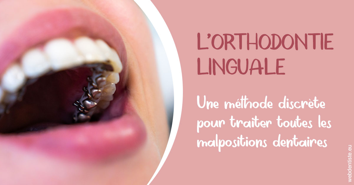 https://dr-voican-ioana.chirurgiens-dentistes.fr/L'orthodontie linguale 2