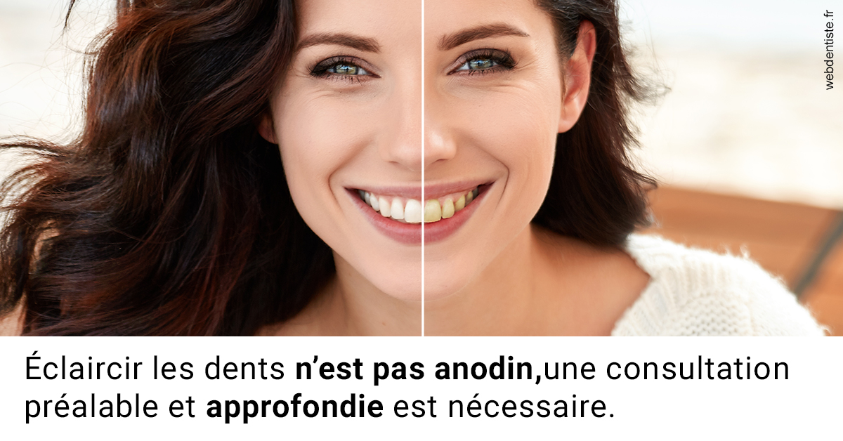 https://dr-voican-ioana.chirurgiens-dentistes.fr/Le blanchiment 2