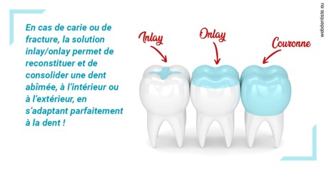 https://dr-voican-ioana.chirurgiens-dentistes.fr/L'INLAY ou l'ONLAY