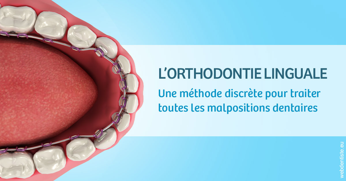 https://dr-voican-ioana.chirurgiens-dentistes.fr/L'orthodontie linguale 1