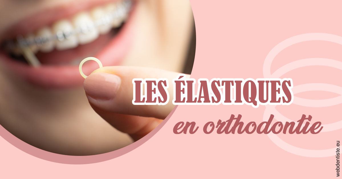https://dr-voican-ioana.chirurgiens-dentistes.fr/Elastiques orthodontie 1