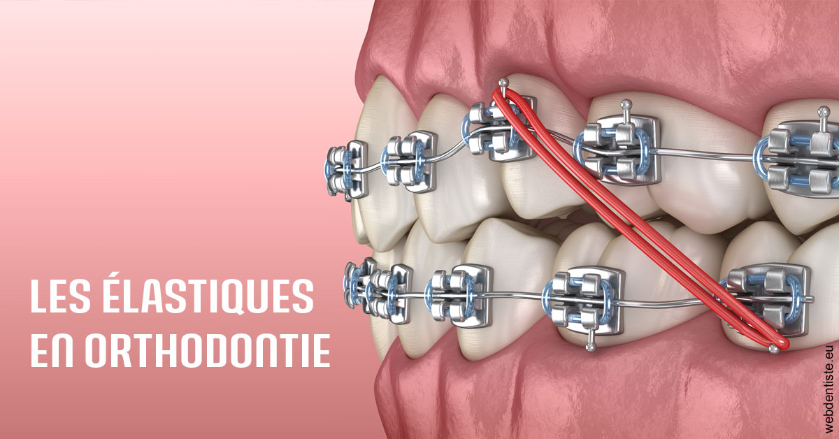 https://dr-voican-ioana.chirurgiens-dentistes.fr/Elastiques orthodontie 2