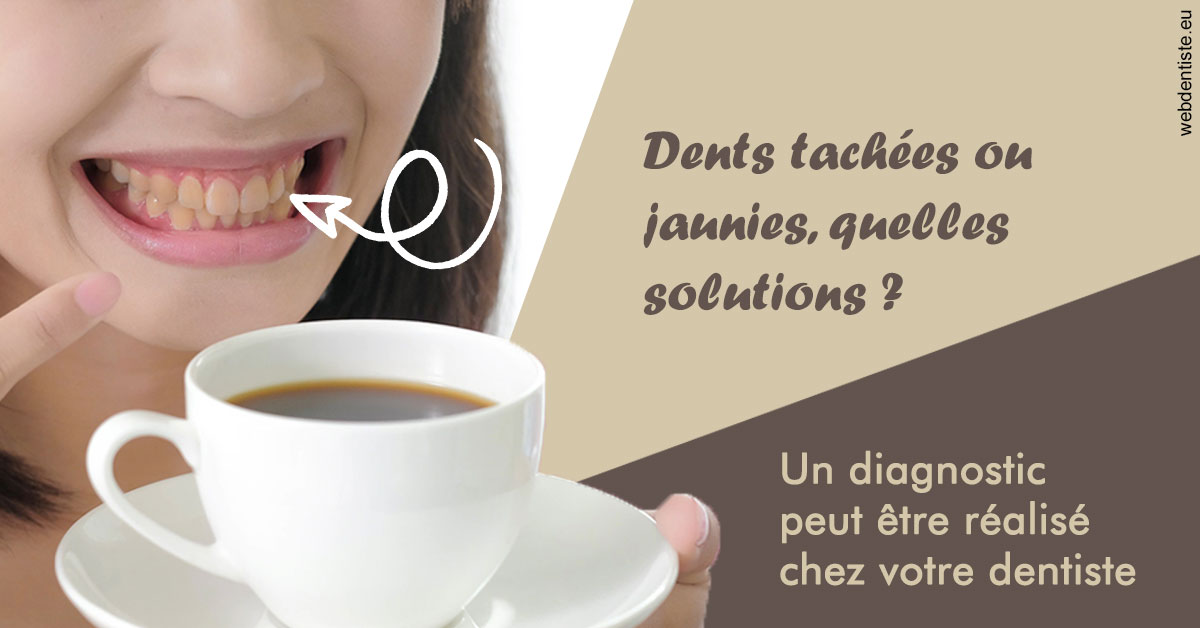 https://dr-voican-ioana.chirurgiens-dentistes.fr/Dents tachées 1