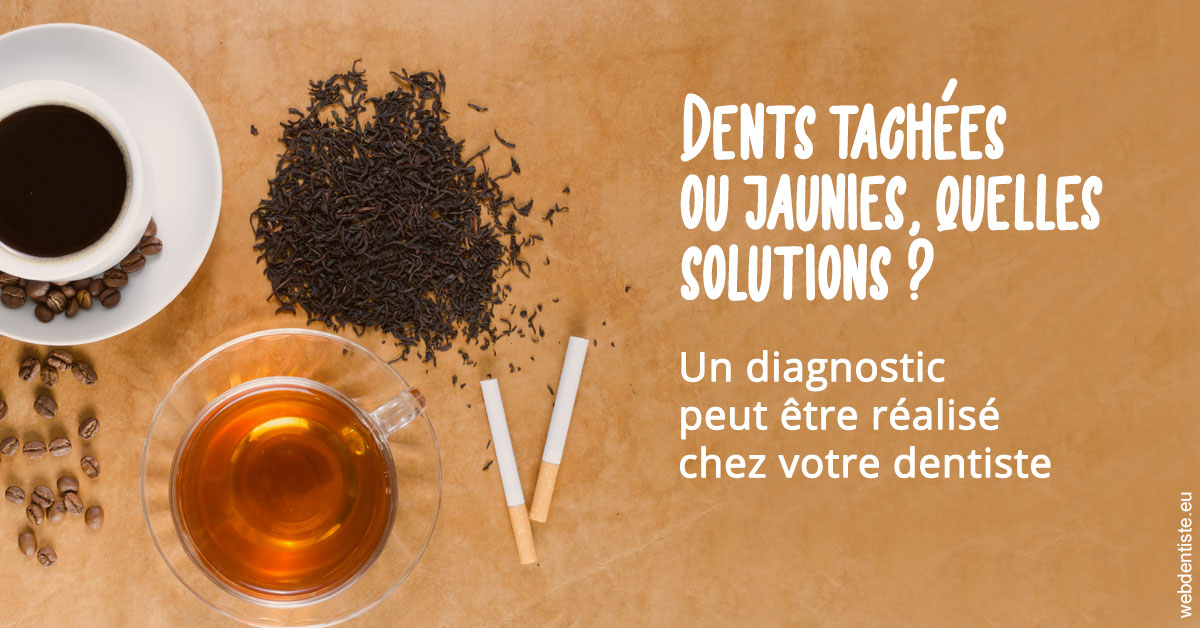 https://dr-voican-ioana.chirurgiens-dentistes.fr/Dents tachées 2
