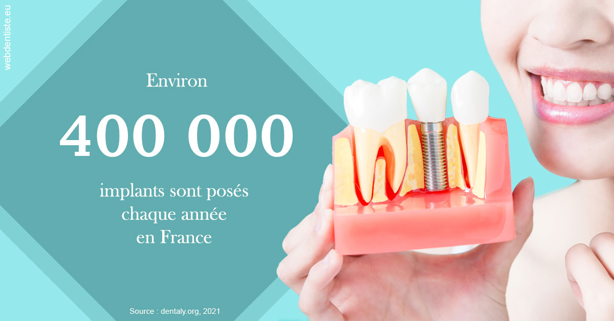 https://dr-voican-ioana.chirurgiens-dentistes.fr/Pose d'implants en France 2